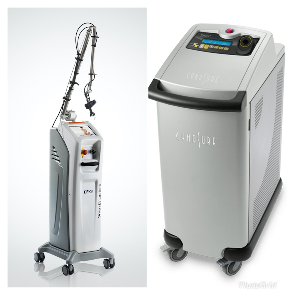 CO2 Dot Laser Treatment in Tulsa, Oklahoma